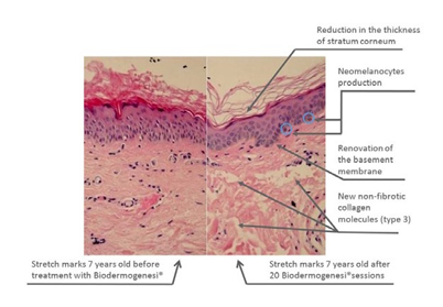 biopsia_pre_e_post_con_testo